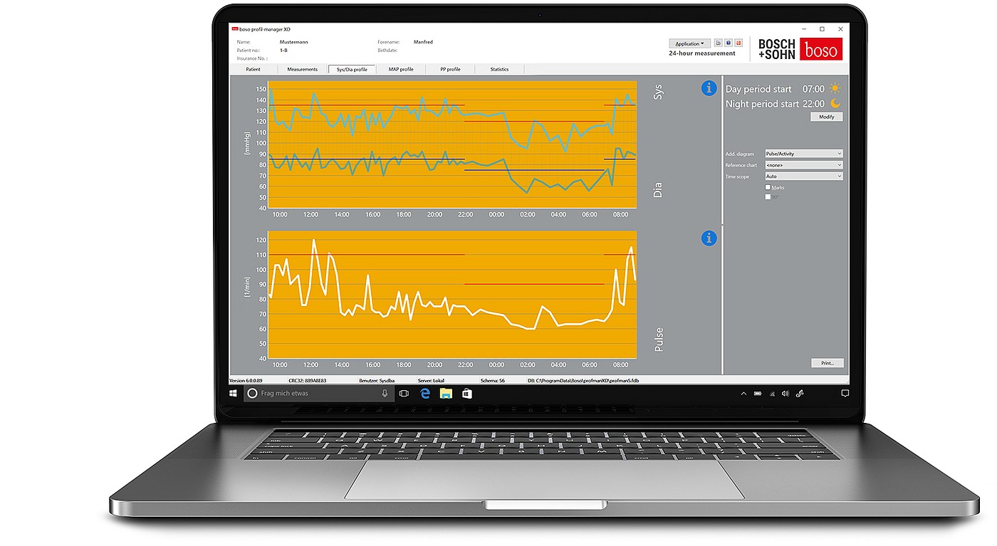 Sys/Dia profile