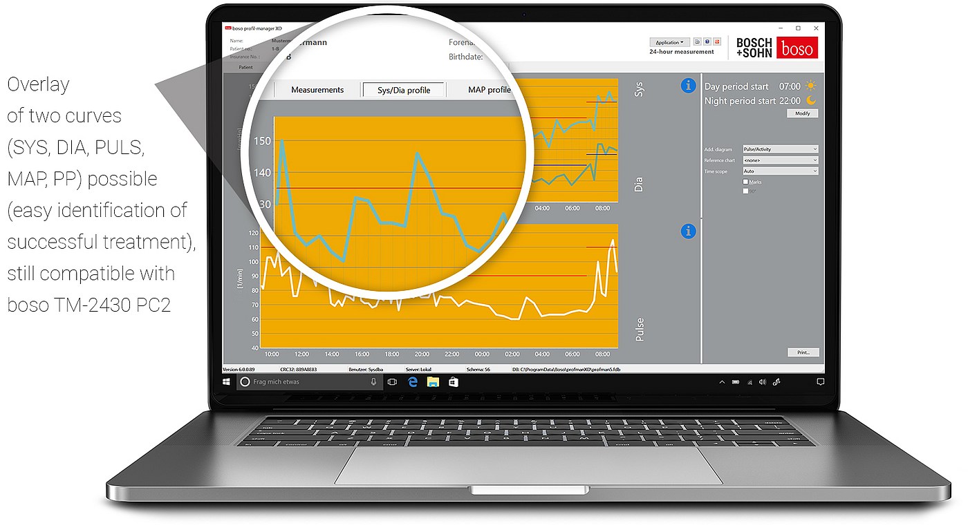 Sys/Dia profile